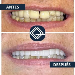 diseño-sonrisa-fuenlabrada (12)