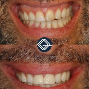 diseño-sonrisa-fuenlabrada (4)