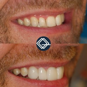 diseño-sonrisa-fuenlabrada (5)