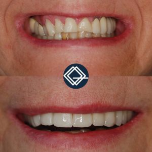 diseño-sonrisa-fuenlabrada (6)