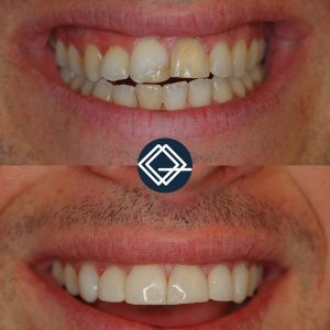 diseño-sonrisa-fuenlabrada (7)