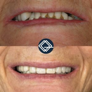 diseño-sonrisa-fuenlabrada (8)