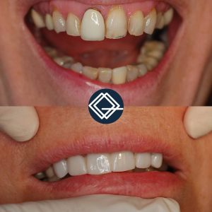 diseño-sonrisa-fuenlabrada (9)